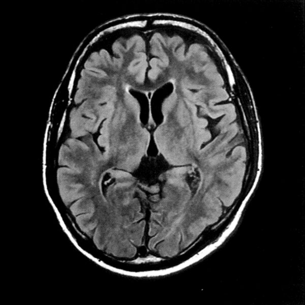 現在の当院のMRI画像 撮像時間2分10秒