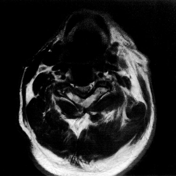 現在の当院のMRI画像 撮像時間1分33秒