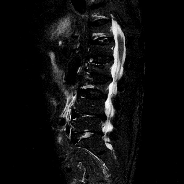 現在の当院のMRI画像 PROPELLER機能使用 撮像時間1分52秒